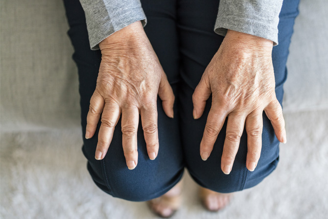 5 Things To Do If You’re Living With Osteoarthritis